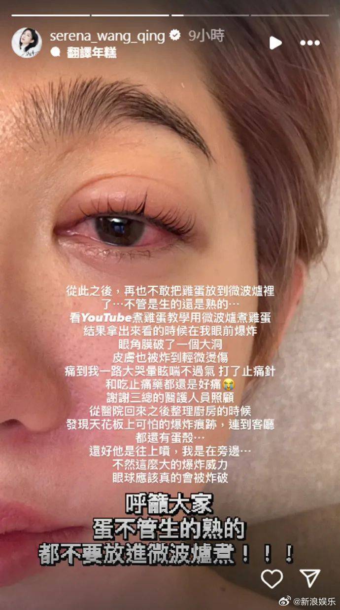 皇冠信用網在哪里开通_突然爆炸皇冠信用網在哪里开通！知名女演员自曝：痛到大哭眩晕